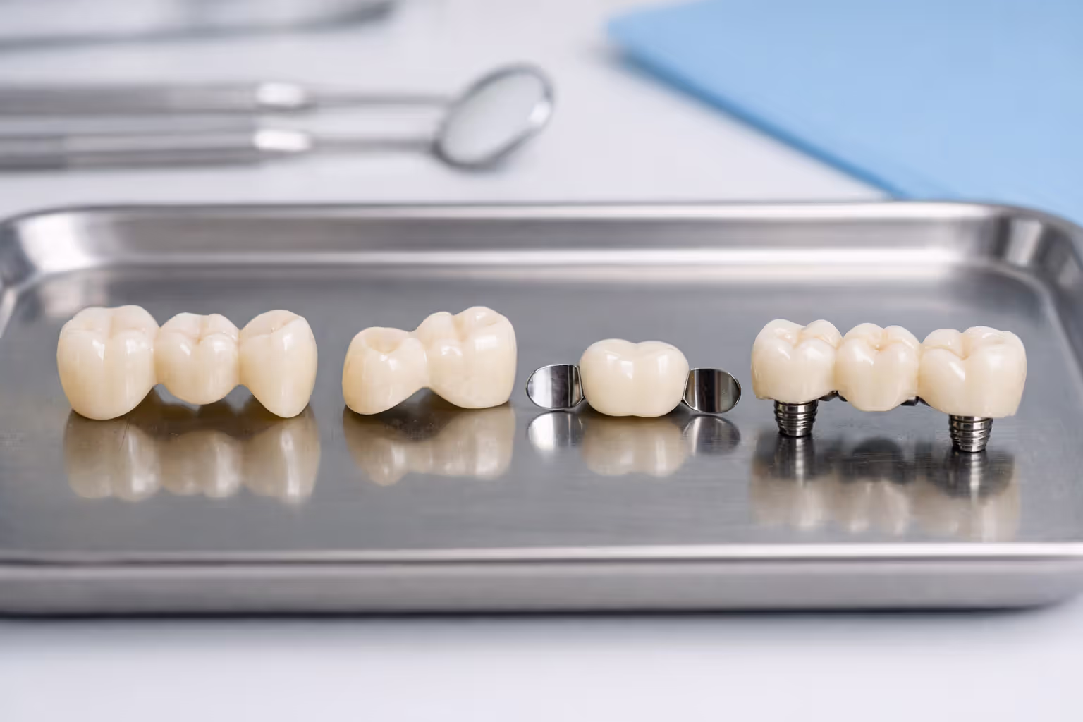 Four types of dental bridges displayed on a dental tray: traditional three-unit bridge, cantilever bridge, Maryland bonded bridge, and implant-supported bridge